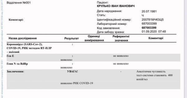 Коронавирус у соратника Тимошенко: нардеп описал симптомы
                                                                                