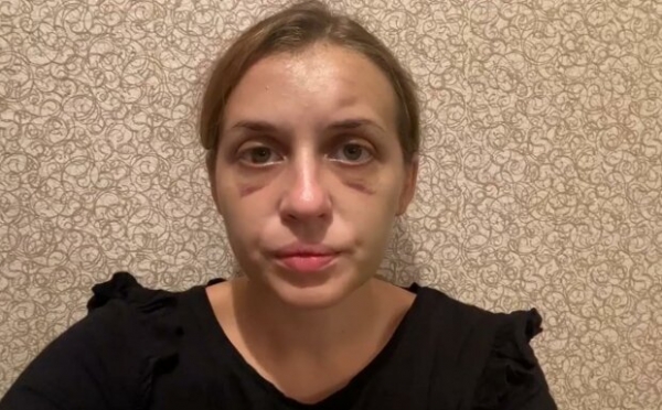 Луговая, которую жестоко избили в поезде, предостерегла родителей: "Готовьте детей ко лжи, изменам и..."