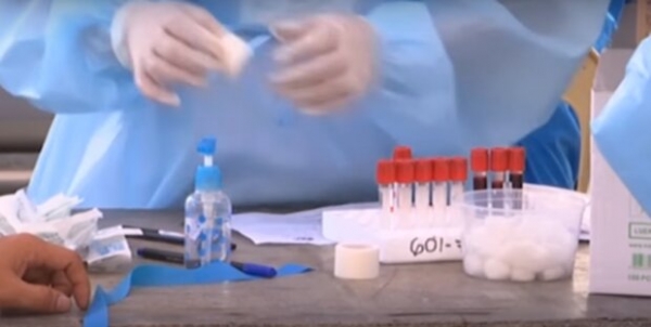 COVID-19 действует выборочно: исследователи выяснили, какие органы поражаются при заражении COVID-19 действует выборочно: исследователи выяснили, какие органы поражаются при заражении