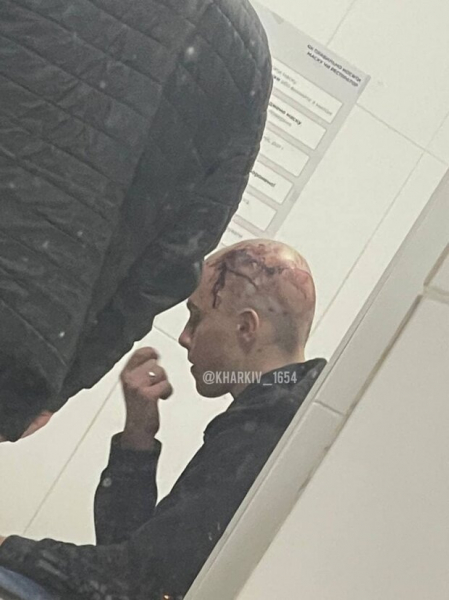 До роковой аварии в Харькове 16-летний мажор едва не сбил человека, появились кадры с телефонов пассажиров: "На красный, под 200..."