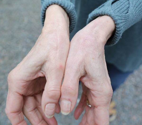 65-летняя бабашука рожала без боли и даже не почувствоваала перелом руки: врачи опешили от пенсионерки 65-летняя бабашука рожала без боли и даже не почувствоваала перелом руки: врачи опешили от пенсионерки