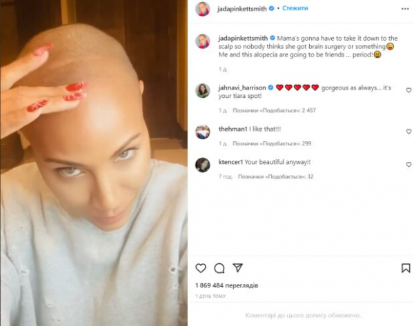 Жена Уилла Смитта полностью облысела, полосы на голове напоминают шрамы Жена Уилла Смитта полностью облысела, полосы на голове напоминают шрамы