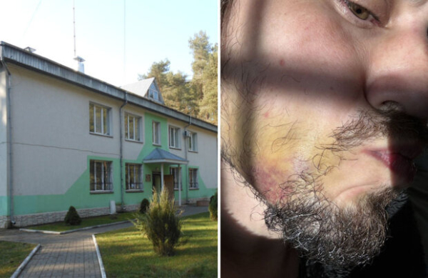 Издевательство и избиение: предприниматель Виктор Звягин много лет под ужасным давлением Издевательство и избиение: предприниматель Виктор Звягин много лет под ужасным давлением
