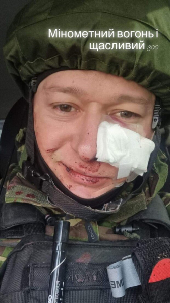 Андрей Хлывнюк, Дмитрий Дикусар, Майкл Щур и Тарас Тополя попали под обстрел - "терминаторы", пережившим ад