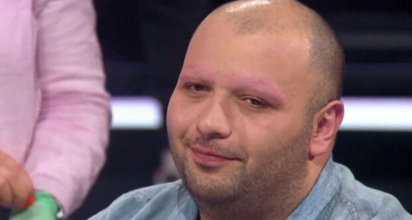 Под ноль - на глазах Притулы парень остался без бровей "ради прикола"