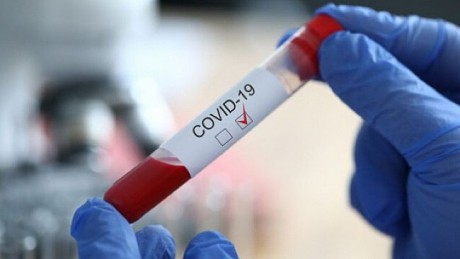 В Киеве коронавирус обнаружили в 35 заведениях торговли продуктами В Киеве коронавирус обнаружили в 35 заведениях торговли продуктами