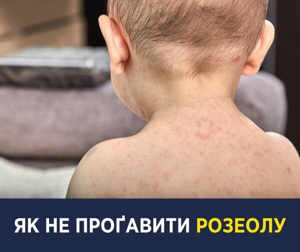 Температура под 40: Супрун рассказала, как распознать опасную инфекцию у малышей Температура под 40: Супрун рассказала, как распознать опасную инфекцию у малышей
