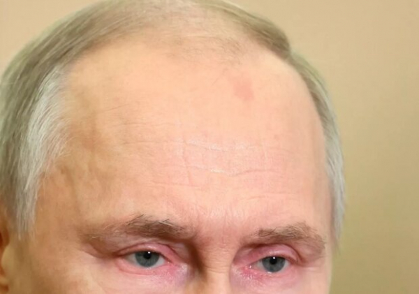 Получил по голове? Путин появился с пятном от удара на лбу
