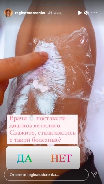 Регина Тодоренко призналась в неизлечимой болезни: "Врачи поставили диагноз" Регина Тодоренко призналась в неизлечимой болезни: "Врачи поставили диагноз"