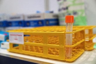 Количество смертей от COVID-19 в Украине перевалило за 85 тысяч
Количество смертей от COVID-19 в Украине перевалило за 85 тысяч