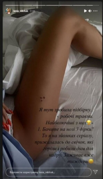 Леся Никитюк показала жуткие травмы, полученные на съемках Леся Никитюк показала жуткие травмы, полученные на съемках