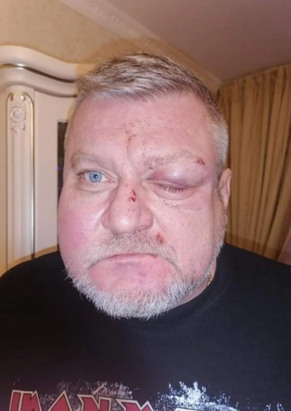 В Херсоне из-за замечания избили депутата: фото В Херсоне из-за замечания избили депутата: фото